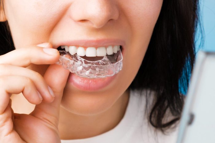 are-snoring-mouthpieces-bad-for-your-teeth