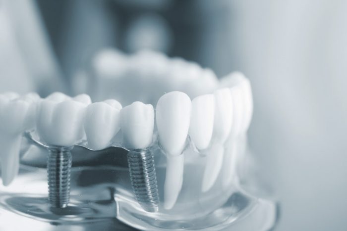 how-can-cosmetic-dentistry-change-my-smile