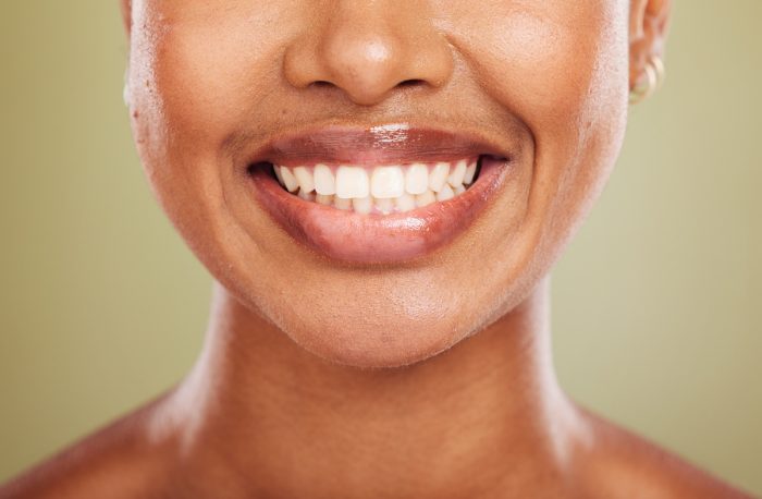 Fastest Way To Straighten Teeth