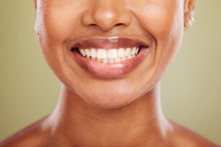 Fastest Way To Straighten Teeth