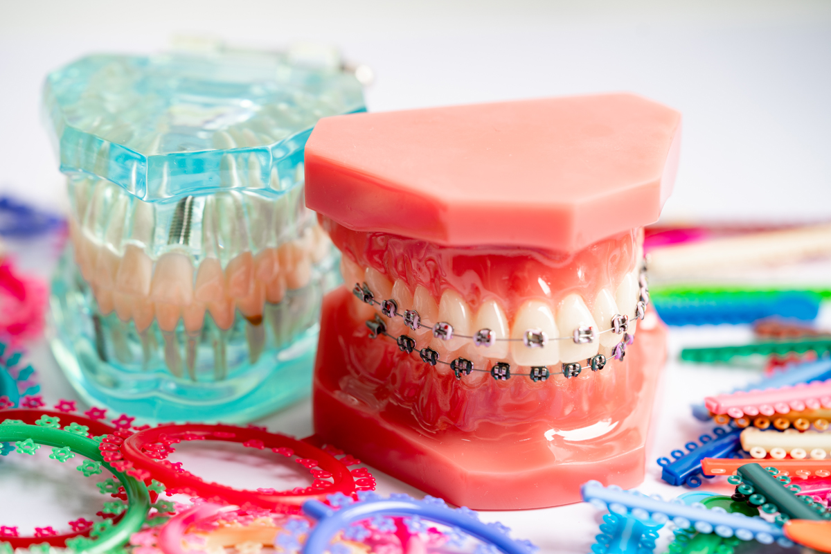 Orthodontics in Pullman, WA – Jonny Fisher DDS