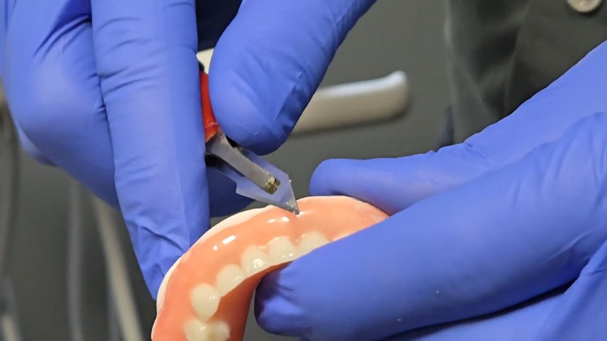 Trimming the edge of a denture for a comfortable fit at a Lewiston, ID dental office